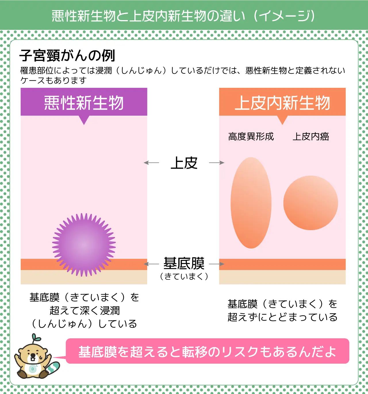 悪性新生物と上皮内新生物の違い(イメージ)